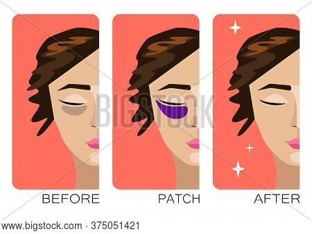 Woman Cartoon Face With Skin Problems Before After Self Or Cosmetology Care. Bruises Under The Eyes.