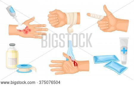 Hands With Injured Skin And Procedures Of Bandaging And Wound Cleaning Vector Set