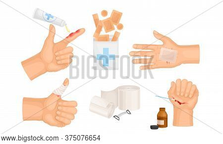 Hands With Injured Skin And Procedures Of Bandaging And Wound Cleaning Vector Set
