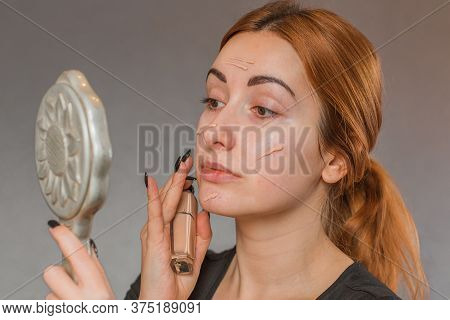 Problem Skin Prone To Rashes And Acne, Acne Scars, Concept Of Healthy Skin, Dermatology And Cosmetol