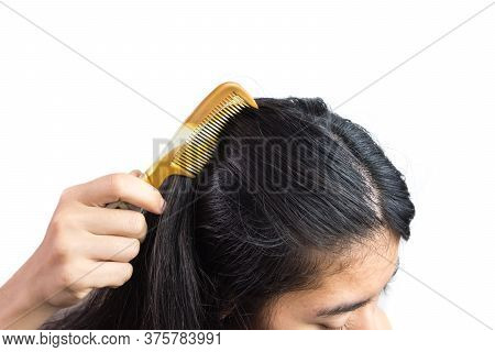Women Head With Dandruff Caused By The Problem Of Dirty. Or Caused By Skin Disease Or Seborrheic Der