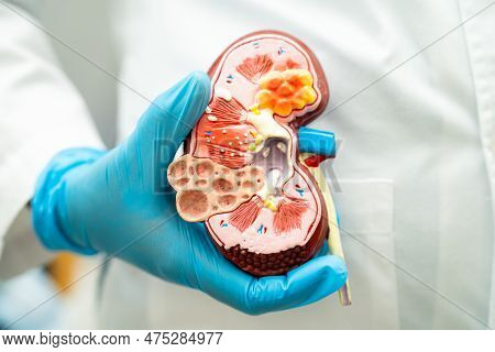 Kidney Disease, Chronic Kidney Disease Ckd, Doctor Hold Model To Study And Treat In Hospital.