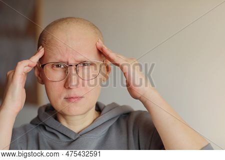 Hairless Woman In Glasses Touching Head With Hands, Suffering From Headache After Chemotherapy. Unha
