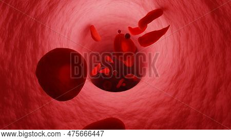 Vein Tunnel. Sickle Cells Circulate In Vein. Erythrocytes And Platelets. Blood Cells Moving Through 