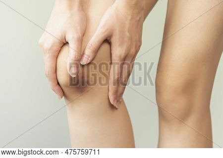 Close Up Of Stain Bruise Wound On Leg, Contusion Asian Young Woman, Girl On Joint Knee From An Accid