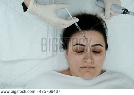 Cosmetologist Applying Face Serum, Preparing Skin For Microneedling