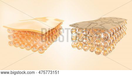 Structure Of Healthy And Damaged Skin, Normal And Dry 3d Render Set. Treatment, Repair And Renewal O