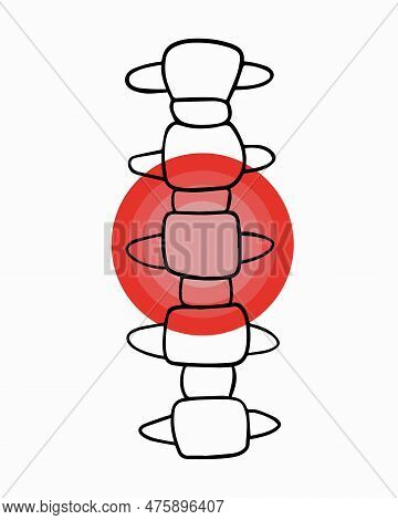 Vector Isolated Illustration Of Cervical Vertebrae Pain. Contour Drawing Of The Cervical Region With