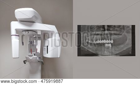 Modern Dental Digital 3d Tomograph. Dental Cone Beam Tomograph, Treatment And Prevention Of Oral Cav