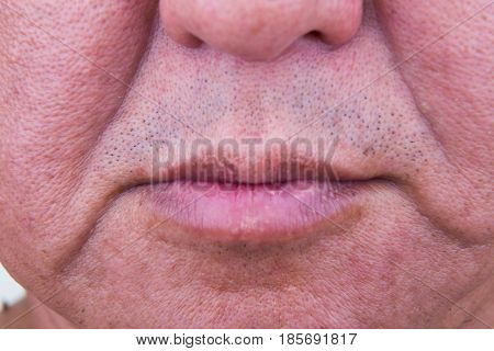 Closeup On Saggy Cheek Image & Photo (Free Trial) | Bigstock