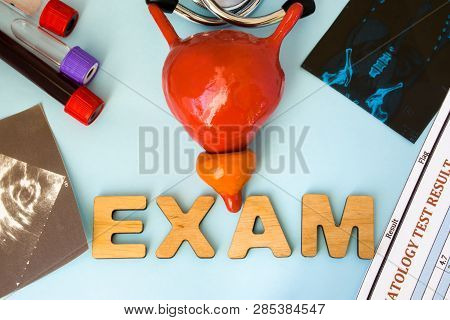 Examination In Urology (urine Bladder Exam) And Endocrinology (prostate Gland). Anatomy Model Of Bla