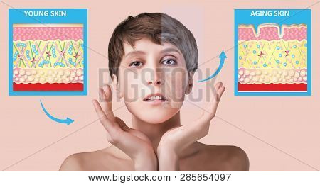The Younger Skin And Aging Skin. Elastin And Collagen. A Diagram Of Young And Old Face Showing The D