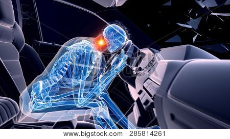 3d rendered illustration of two colliding cars - illustrating the effect of an impact without airbag