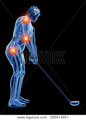 3d rendered medically accurate illustration of the skeleton of a golf player with painful joints