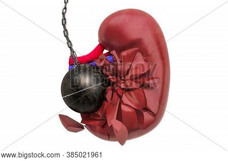 Kidney Destroying By Wrecking Ball. Pain In Kidneys, Chronic Kidney Disease Concept. 3d Rendering Is