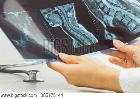 Female Doctors Hand Pointing At X-ray Or Mri Medical Imaging With A Head And Neck Condition. Spinal 