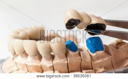 Prothetischen Dentallabor, technische Aufnahmen