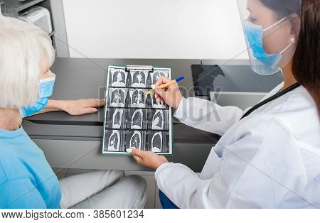 Pulmonologist Showing A Senior Patient A Ct Scan Of Her Lungs. Pneumonia, Coronavirus, Lung Disease