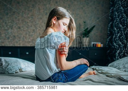 Young Brunette Girl Sits On A Bed In Her Room, Holds Her Injured Shoulder With Her Hand