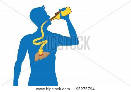 Snake out of alcohol bottle into body to attack liver while people drinking. Illustration about health care.