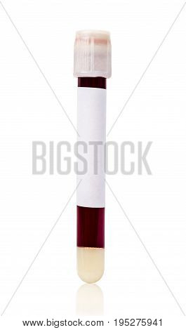 White vacuum blood tube test with sample blood for Medical laboratory isolated on white background clipping path.