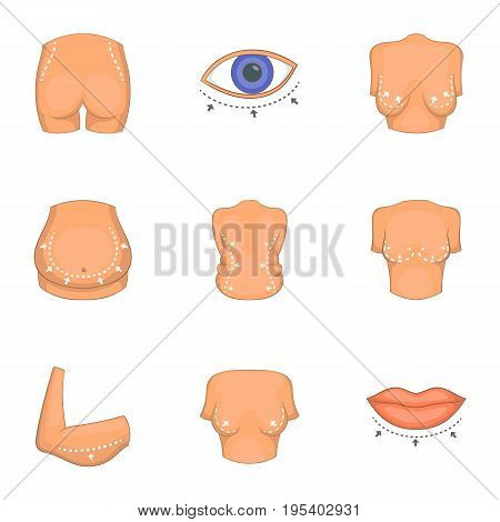 Type of liposuction icons set. Cartoon set of 9 type of liposuction vector icons for web isolated on white background