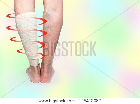 The female legs. Varicose veins. Phlebeurysm. Thrombophlebitis and elastic bandage