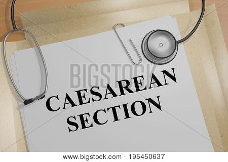 Caesarean Section - Medical Concept