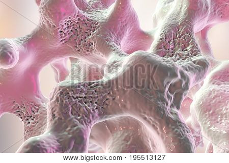 Spongy bone tissue affected by osteoporosis, 3D illustration