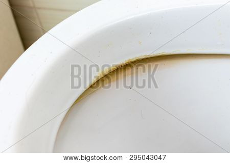 Dirty Unhygienic Toilet Rim With Limescale And Rust Stain At Public Restroom Close Up