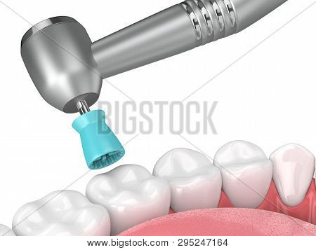 3D Render Of Jaw With Dental Handpiece And Polishing Prophy Cup