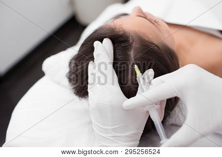 Treatment Of Hair Loss, Injection For Hair Growth. Injected In Womans Head, Hair Mesotherapy