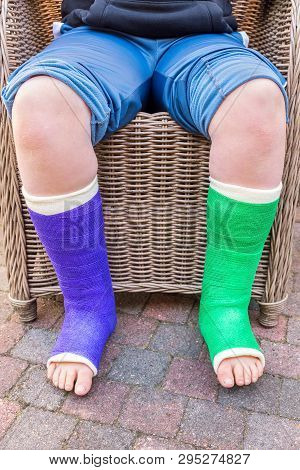 Teenage Boy Sitting In Chair With Two Colored Gypsum Legs Outside