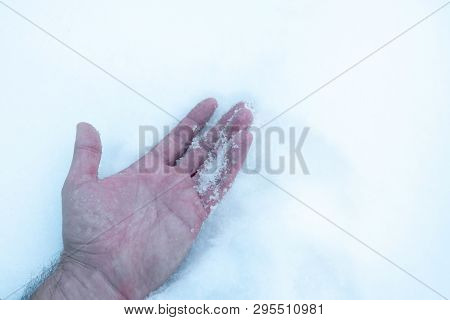 The Man's Hand In The Snow, Frozen Got Hypothermia Frostbite