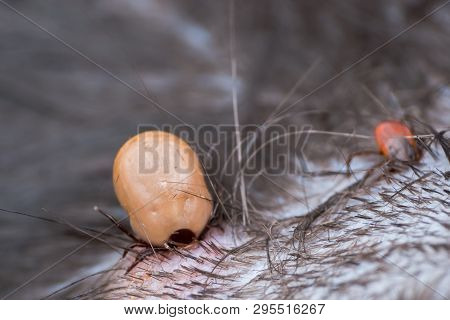 Two Ticks With Diferent Sizes Sucking Blood From The Cat Skin