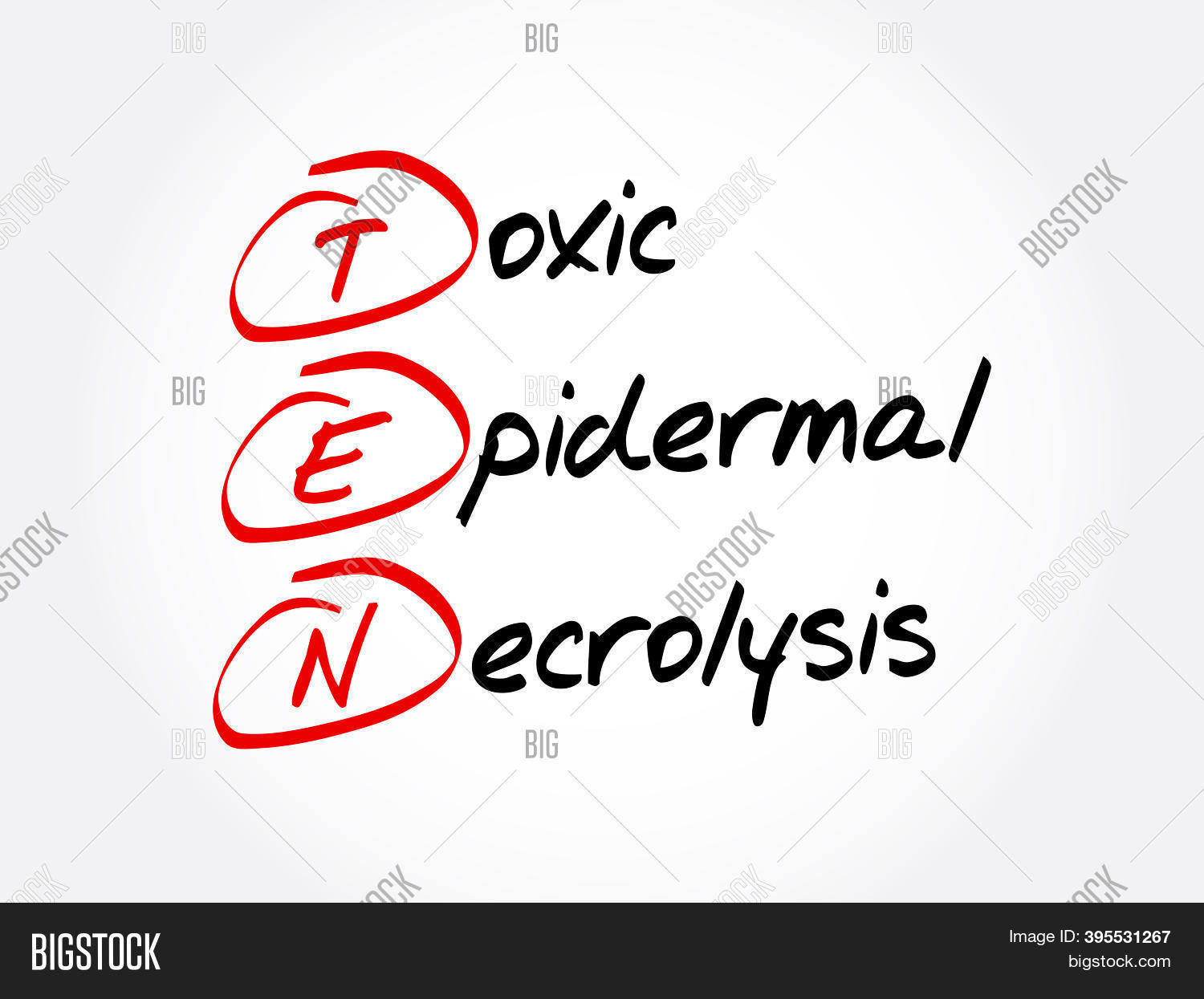 Ten - Toxic Epidermal Image & Photo (Free Trial) | Bigstock