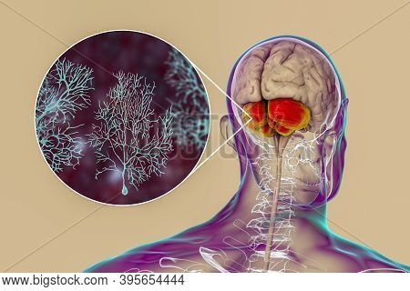 Human Brain With Highlighted Cerebellum And Close-up View Of Purkinje Neurons, One Of The Commonest 