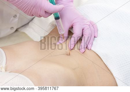 Lipolytic Injections Are Placed In The Stomach. Female Hands In Pink Gloves Inject A Young Woman Int