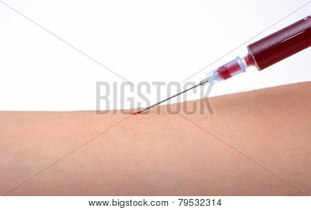 Blood Sampling With Syringe And Needle For Analysis