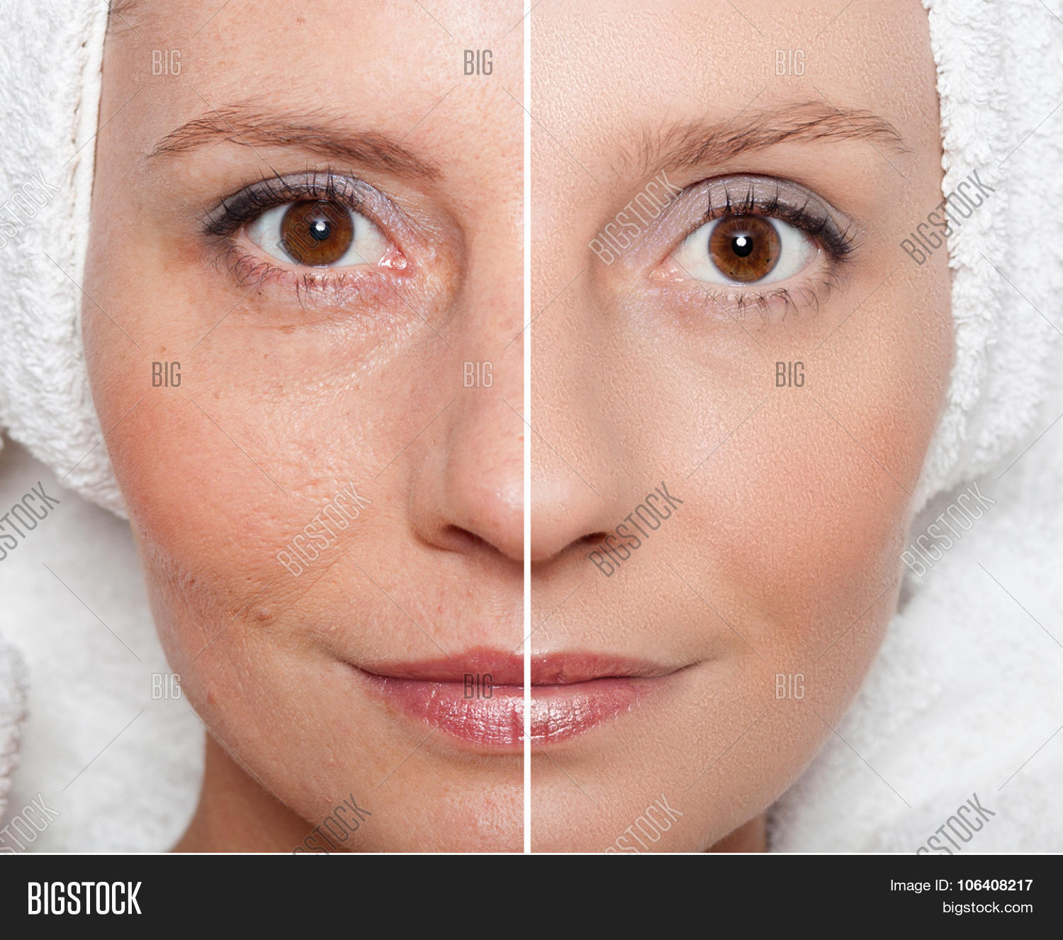 Beauty Concept - Skin Image & Photo (Free Trial) | Bigstock