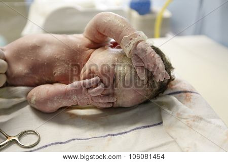 Vernix Covered Newborn