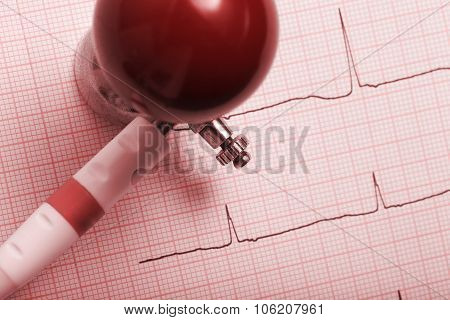 Picture Of The Patient's An Electrocardiogram