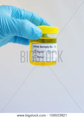 Urine exam