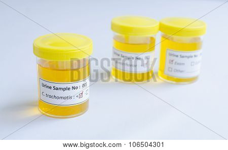 Chlamydia trachomatis positive