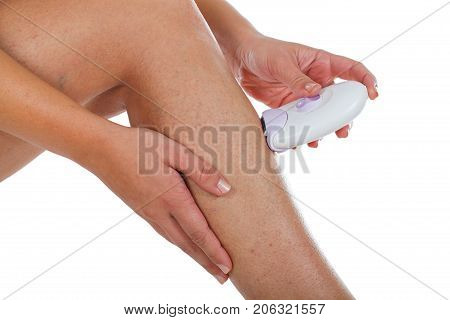 Close up picture of young woman epilating legs spider veins because of hormonal change - isolated