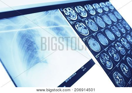 Survey results on the negatoscope in doctor's office.
