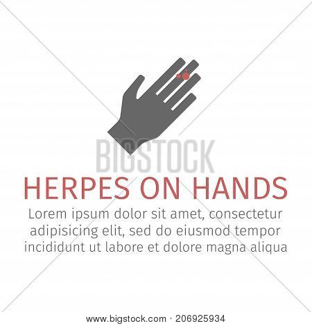 Herpes on hands. Vector icon for web graphic.