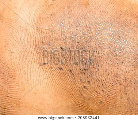 dirty background of human skin . Photo of abstract background