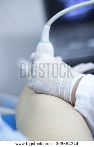 Epi Dry Needling Ultrasound Scan