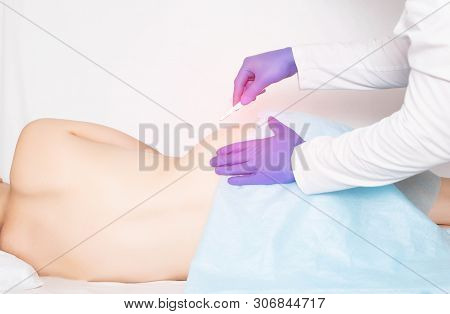 Doctor Surgeon With A Scalpel Makes An Incision To The Patient To Replace An Artificial Hip Joint, H